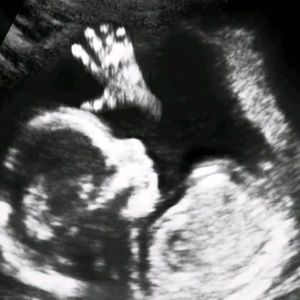 Meet your Posher, Puro